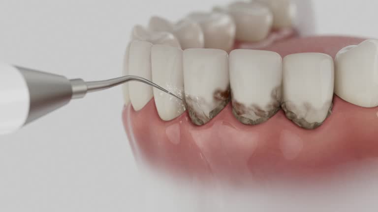Reliable Invisalign Clear Aligners contractor in Jefferson County County, MS by Dentist Open Now